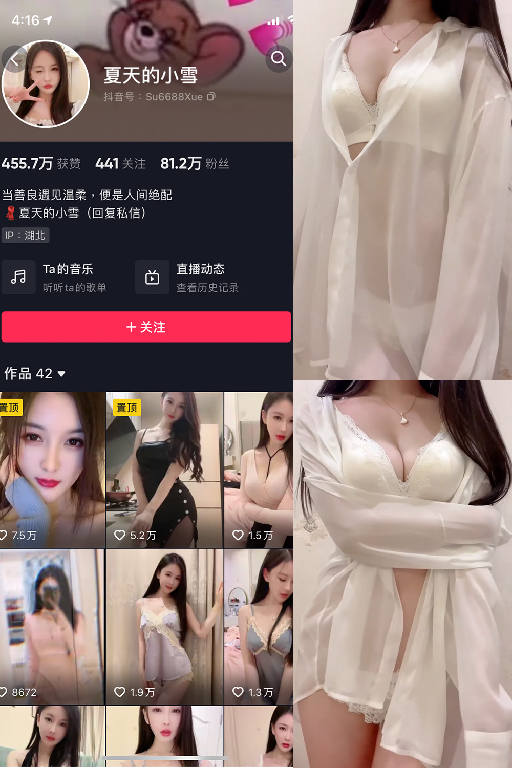 图片[1]-抖音 夏天的小雪 微密圈 嘉宾专享 NO.011期 【4P2V】最新至：2023.8.11-微密空间-全网最全抖音网红铁粉空间写真